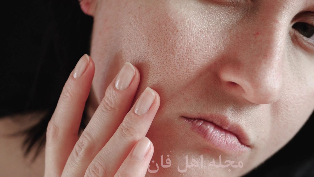 کاهش منافذ باز پوست