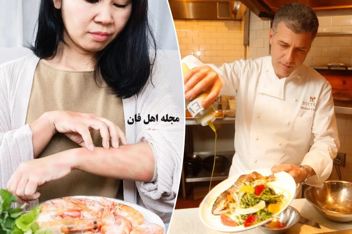 حساسیت غذایی
