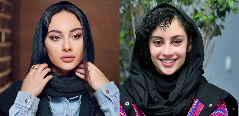 تغییر چهره 6 بازیگر زن ایرانی 1