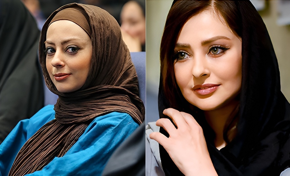 تغییر چهره 6 بازیگر زن ایرانی 4