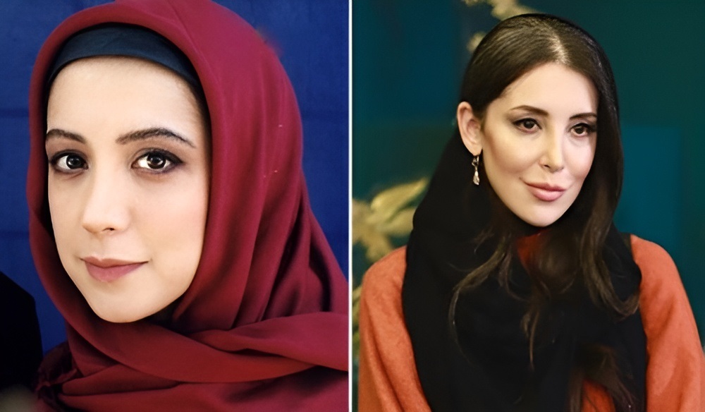 تغییر چهره 6 بازیگر زن ایرانی 5