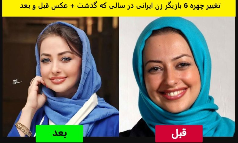 تغییر چهره 6 بازیگر زن ایرانی