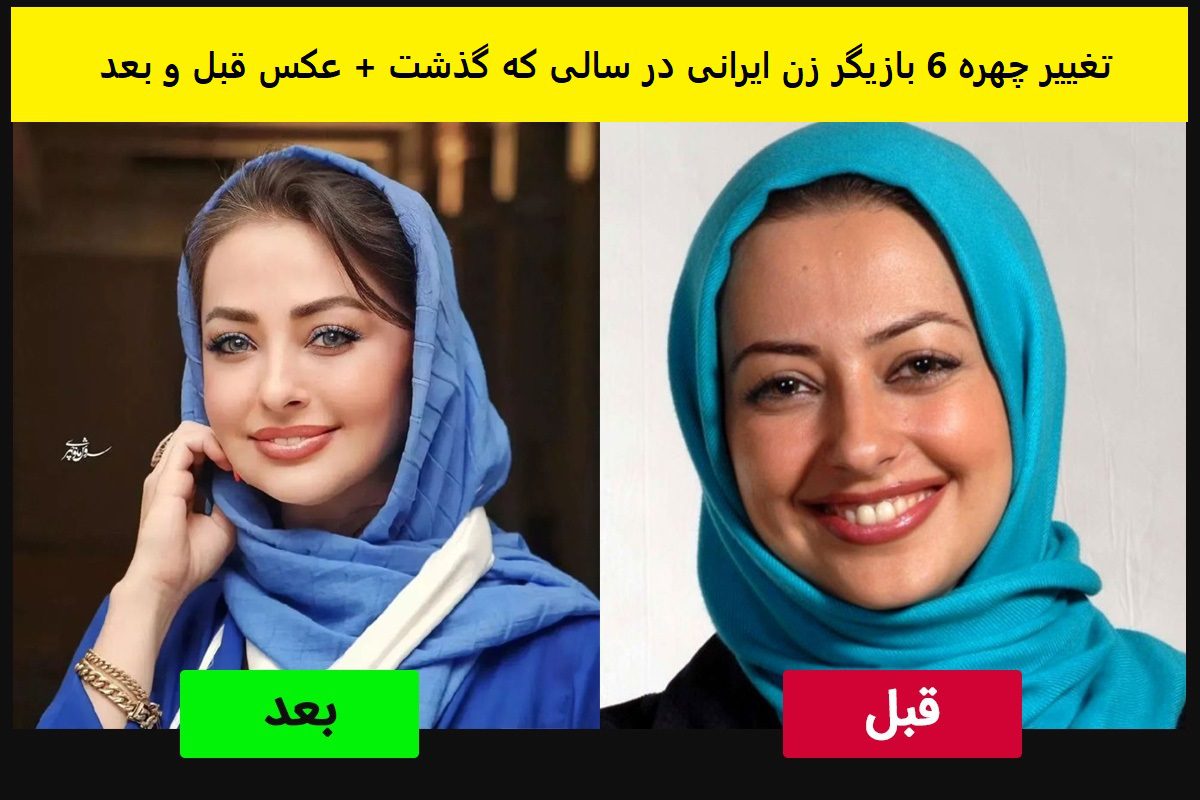 تغییر چهره 6 بازیگر زن ایرانی