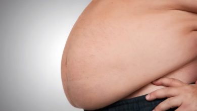چاقی شکم و پهلو در زنان و مردان