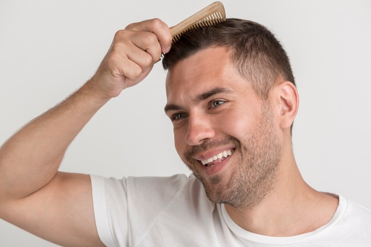 درمان ریزش مو در مردان-2